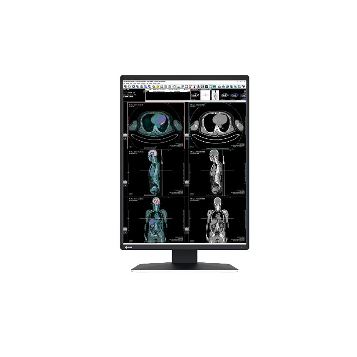 EIZO MONITOR MEDICALE 21,3 LED IPS 1536 X 2048 3:4 25 ms 1100 CDM, DP/DVI, PIVOT, RADIFORCE RX2370